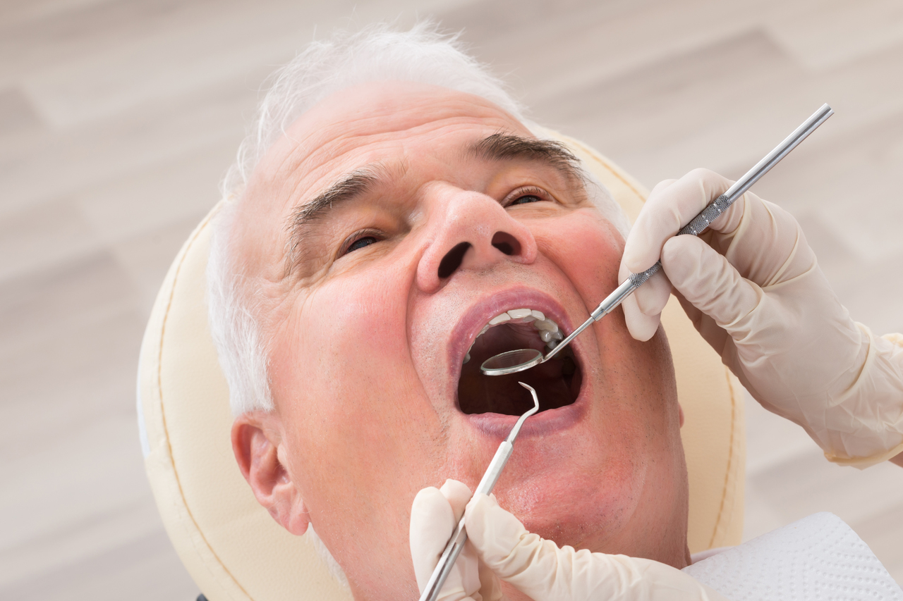 入れ歯の型取りの治療